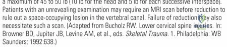 Illustration of treatment general cervical - Dr. Mohammed Hutaif