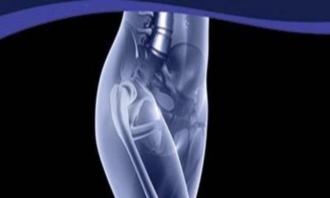 Orthopedic Recon Hip & Knee Board Review | Dr Hutaif Hi -...