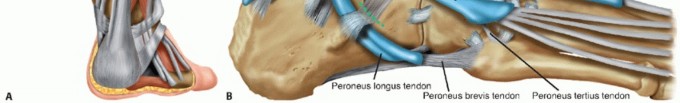 Chronic Ankle Instability: Plantaris Longus Tendon Reconstruction