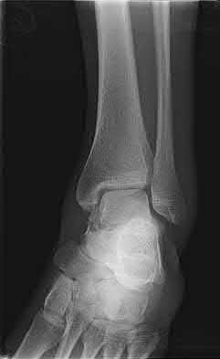 Illustration 118 for OrthoCash: Trauma MCQs & Cases for a yearold woman