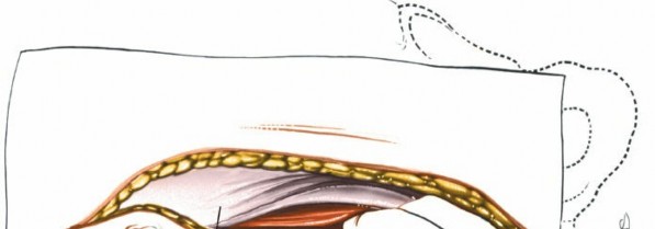 Illustration 61 for Approach to the Lumbar Spine: Mastering Techniques & Anatomy