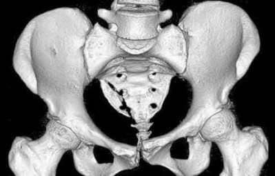 Illustration 127 for OrthoCash: Trauma MCQs & Cases for a yearold woman