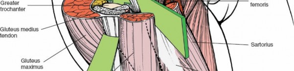 Illustration 166 for Unlocking Every Aspect of the Hip's Surgical Approaches