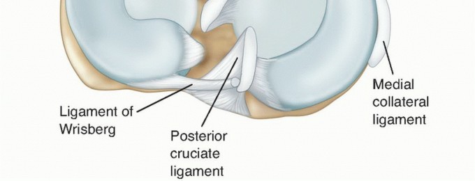Illustration 2 for Symptomatic Knee? Meniscal Transplant for Anterior & Posterior Horns