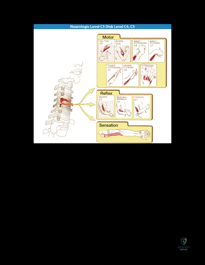 صورة توضيحية لـ جراحة تعديل حوض الورك الثلاثية: حل متقدم لتشوهات الورك المعقدة للأطفال واليافعين
