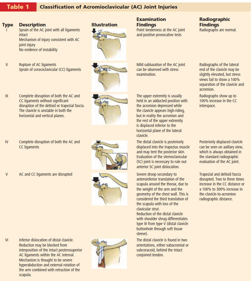 Illustration of distal clavicle resection - Dr. Mohammed Hutaif