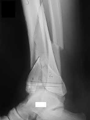 Illustration 96 for OrthoCash: Trauma MCQs & Cases for a yearold woman