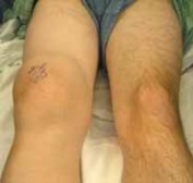 Illustration of portal and the shaver - Dr. Mohammed Hutaif