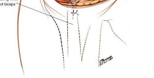 Illustration 99 for Essential Guide: Mastering Every Approach to the Shoulder