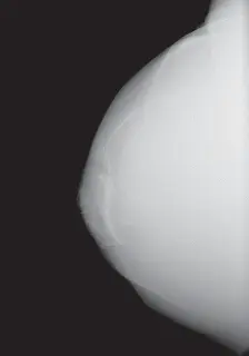 استبدال مفصل الركبة الكلي للركبة الروحاء: تقنيات متقدمة وتجنب التحديات مع الأستاذ الدكتور محمد هطيف