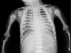 Pediatric Orthopaedic MCQs: Expert Insights et al Reviewed