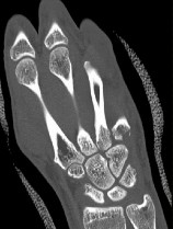 وصف طبي دقيق ومبسط للمريض