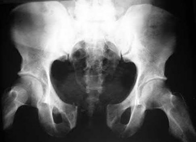 Illustration 207 for OrthoCash: Trauma MCQs & Cases for a yearold woman