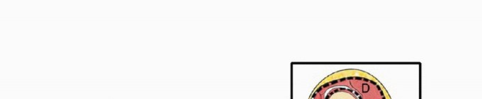 Limb-Sparing Quadriceps Resection: Superficial Femoral Artery