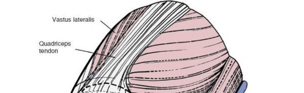 Illustration 84 for Mastering Knee Approaches: Spotlight on Superficial Medial Ligament