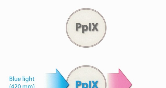 Illustration 4 for Targeted Ablation of Musculoskeletal Tumors: A Safer Approach