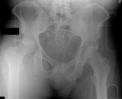 Illustration 153 for OrthoCash: Trauma MCQs & Cases for a yearold woman