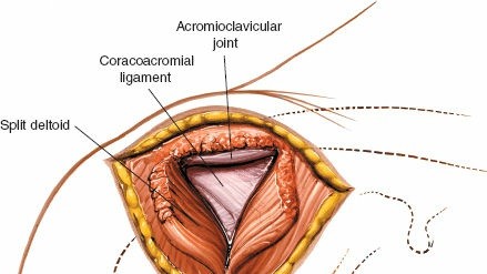 Illustration 95 for Essential Guide: Mastering Every Approach to the Shoulder