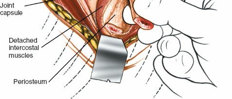 Illustration 300 for Approach to the Lumbar Spine: Mastering Techniques & Anatomy