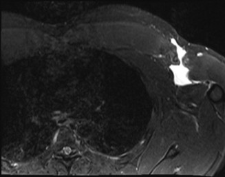Illustration 28 for Solve Shoulder & Elbow Cases: When a Patient Presents to Clinic