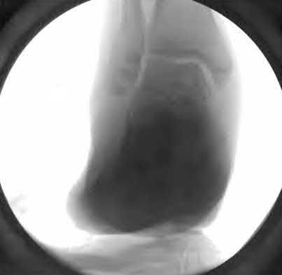 Illustration 144 for OrthoCash: Trauma MCQs & Cases for a yearold woman