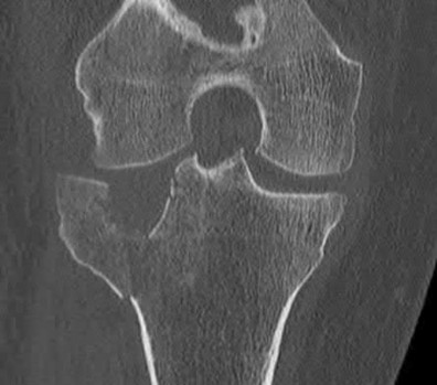 Illustration 26 for OrthoCash: Trauma MCQs & Cases for a yearold woman