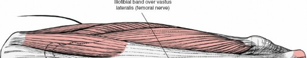 Illustration 16 for Optimal Femoral Approaches: Mastering the Lateral Intermuscular Septum