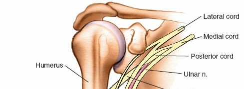 Illustration 10 for Medial Approach to the Distal Humerus: Master Techniques & Avoid Osteotomy