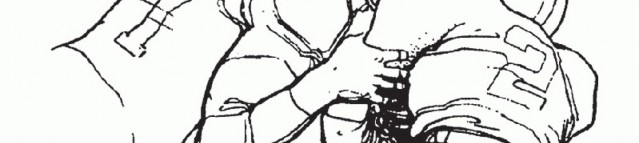 Illustration 6 for Restore Your Foot: Surgical Treatment for Hallux MP Joint Turf Toe