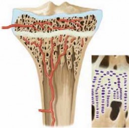 Illustration of excision of physeal bar - Dr. Mohammed Hutaif
