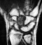 صورة طبية: دليل الأستاذ الدكتور محمد هطيف الشامل لأمراض وإصابات اليد والمعصم في صنعاء