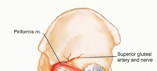Illustration 10 for Surgical Pelvic Resection: Gluteus Maximus Muscle & Nerve Preservation