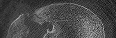 Illustration 27 for OrthoCash: Trauma MCQs & Cases for a yearold woman