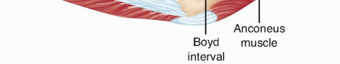 Illustration 26 for Radial Head & Neck Fractures: Mastering ORIF for Best Results