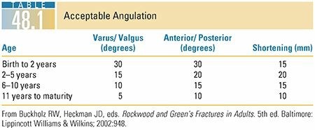 Illustration 4 for Master Pediatric Femoral Shaft & Knee Fractures: Interactive Module