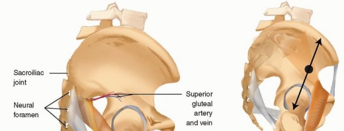 Illustration 28 for Emergency Fixation of the Pelvis: Control Bleeding & Restore Stability