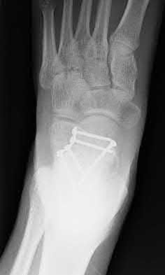 Illustration 122 for OrthoCash: Trauma MCQs & Cases for a yearold woman