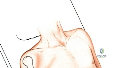 AAOS指南 | 2022前交叉韧带损伤的临床实践指南解读