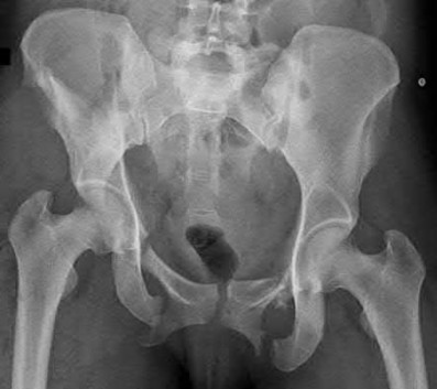 Illustration 177 for OrthoCash: Trauma MCQs & Cases for a yearold woman