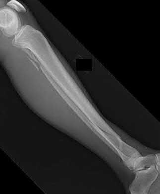 Illustration 195 for OrthoCash: Trauma MCQs & Cases for a yearold woman