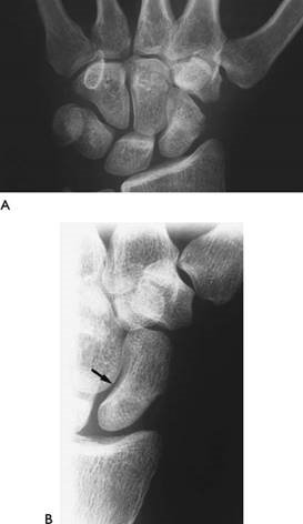 Illustration 9 for Master Hands and Paediatric Orthopaedics: Diagnose & Treat