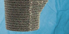 Illustration 6 for S-ROM: Inside the Technique of Modular Implant Design