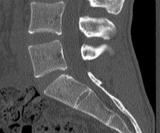 Illustration 41 for Master Orthopedic Spine Cases: Sharpen Your Diagnostic Skills
