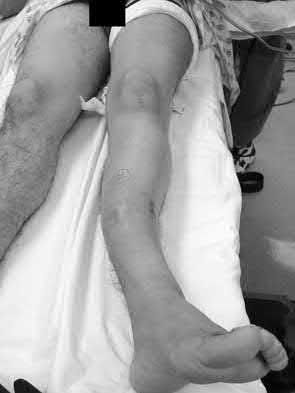 Illustration 139 for OrthoCash: Trauma MCQs & Cases for a yearold woman