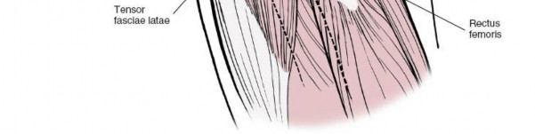 Illustration 6 for Unlocking Every Aspect of the Hip's Surgical Approaches