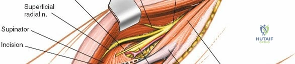 ABOS Part I & AAOS OITE Orthopaedic Surgery Review: Spine Trauma & Lateral Epicondylitis | Part 21598