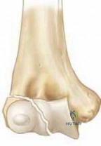 Orthopedic Surgery Board Review: ABOS Part I & AAOS OITE Comprehensive MCQs | Part 21590