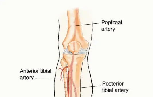 ترقيع الشظية الوعائي الحر: حلول متقدمة لعيوب العظام المعقدة