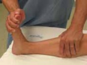 Illustration 12 for Optimal Fixation of the Ankle: Open Reduction & Internal Fixation