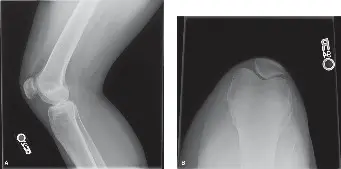 صورة توضيحية لـ دليلك الشامل لإصابات الملاعب: التشخيص والعلاج مع الأستاذ الدكتور محمد هطيف في صنعاء